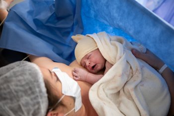 cesáreas, cesárea de emergencia, cesaréas de menor impacto, cicatriz de cesárea pequeña